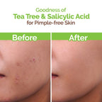Mamaearth Tea Tree Face Wash 80ml