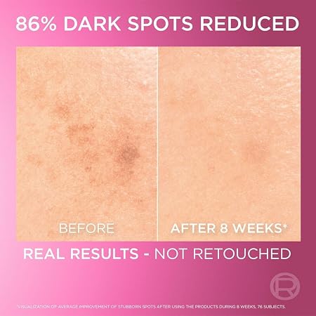 L'Oréal Paris Glycolic-Bright Instant Glowing Serum 30ml