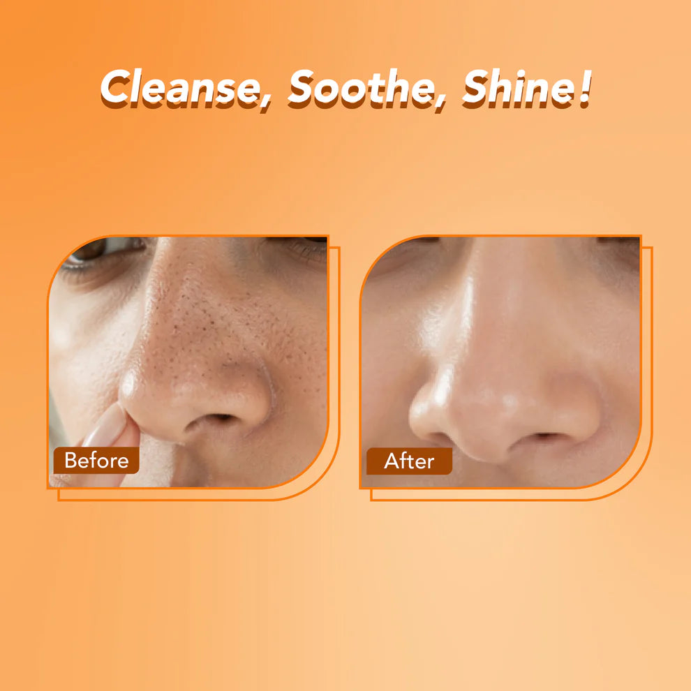 DR.RASHEL Beauty Elixirs Nose Pore Strips – Vitamin C 10 Strips
