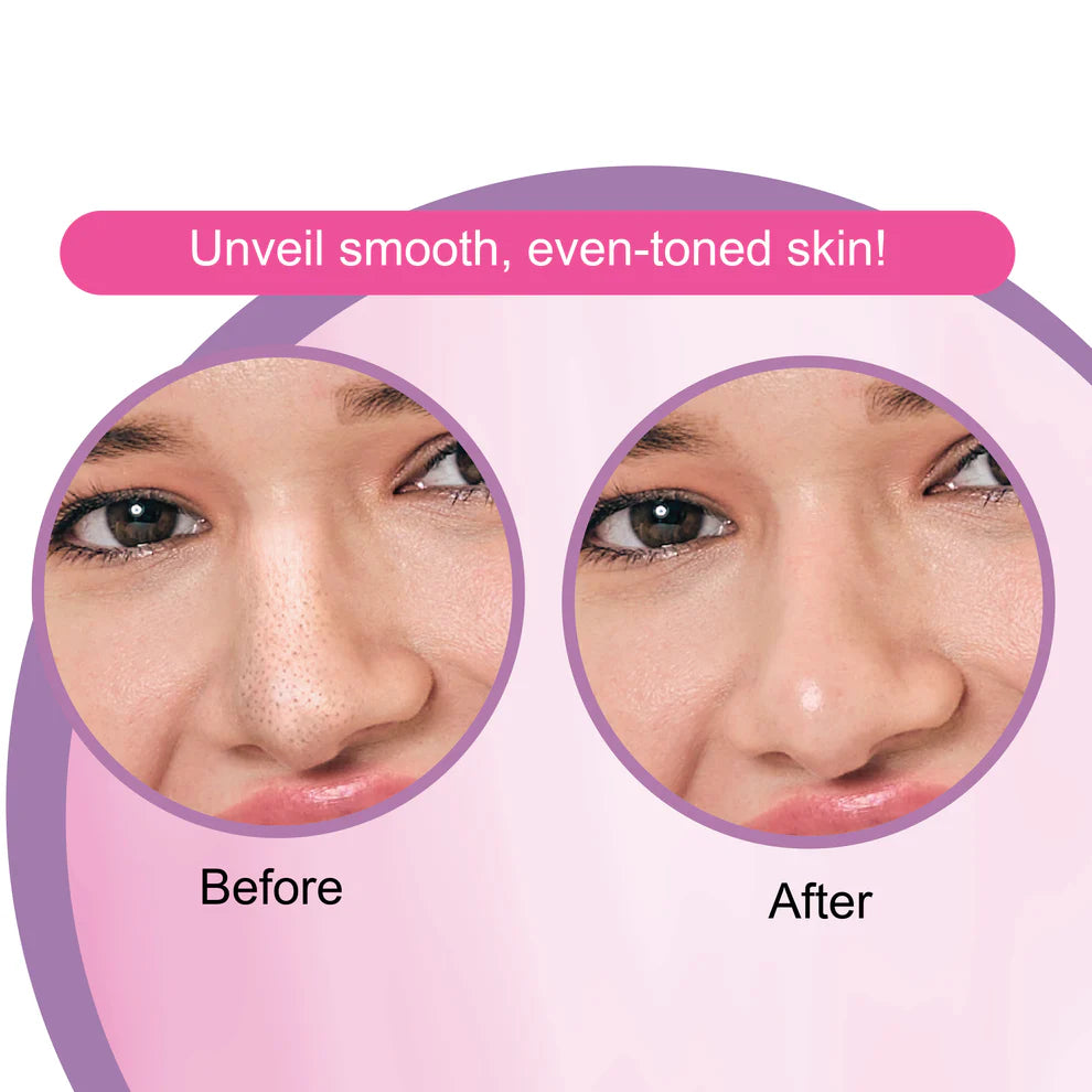 DR.RASHEL Beauty Elixirs Nose Pore Strips – White Skin 10 Strips