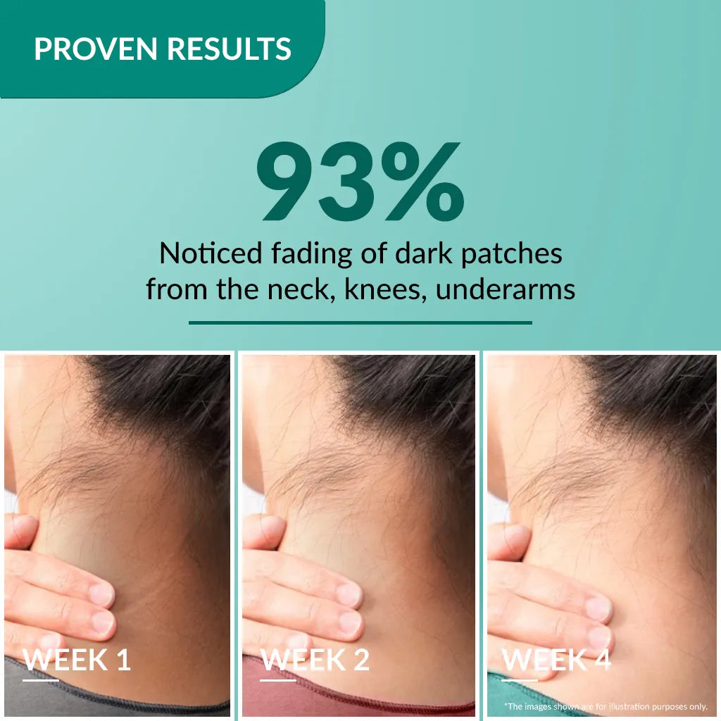 Fixderma Nigrifix Cream 50g