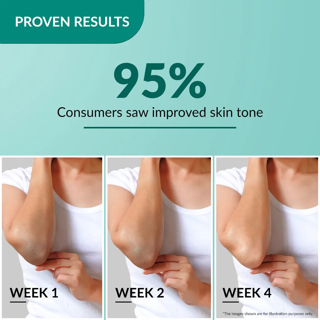 Fixderma Nigrifix Cream 50g